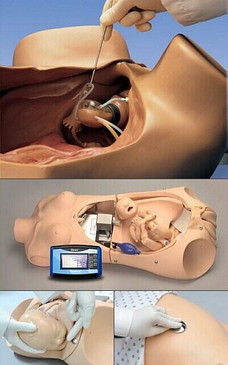 Ginecología y Obstetricia