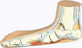 Pie Plano (Pes Planus)  M31