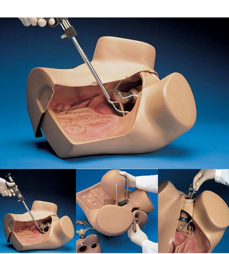 Simulador ginecológico Zoe para prácticas clínicas normales y laparoscopía S504.100